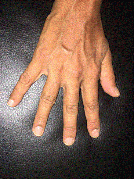 The World's Longest Fingernails on a Single Hand | Hindi Language Blog