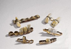 'The Etruscans, who predated the Romans, practiced making dentures and implants as early as the 7th century BCE. They used gold wires, gold strips, and gold rivets in their intricate dentistry.